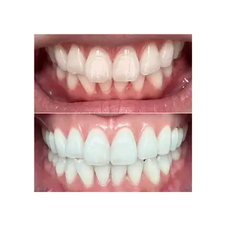 ホワイトニングジム 池袋のその他イメージ