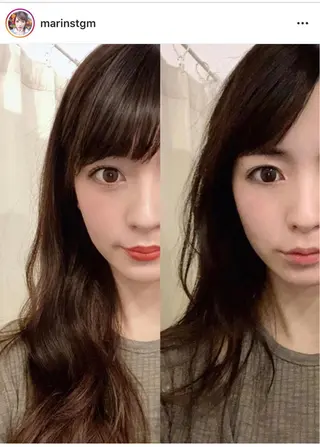 毛穴/ピーリング ララピール/POLAのエステ・リラクイメージ