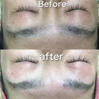 脱毛サロン KiWiのエステ・リラクイメージ