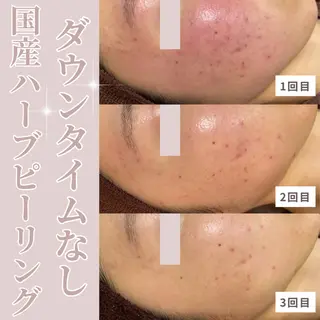 透明感/美肌 綾野のエステ・リラクイメージ