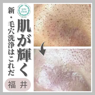 毛穴ケア専門サロン Yourmeユアミーのエステ・リラクイメージ