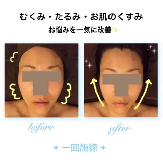 ダイエット・美肌ケア fleurのエステ・リラクイメージ