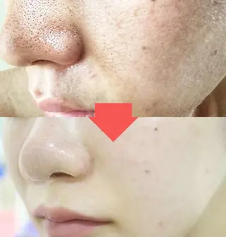 西区九条エステ MITUREIサロンのエステ・リラクイメージ