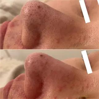 ✨美肌水光✨ アトリエリュバンのエステ・リラクイメージ