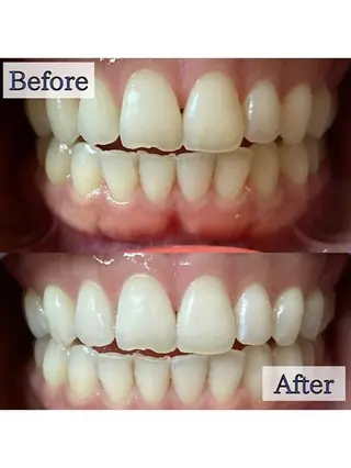 LBSホワイトニング上野店所属・LBSホワイトニング 🌐 上野店公式のエステ・リラクイメージ