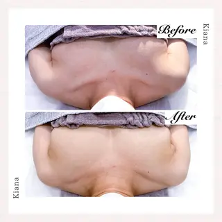 バスト専門Kiana 風のエステ・リラクイメージ