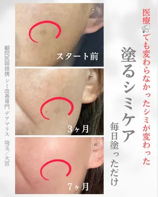 private salon  Dea_maris シュガーリング＆パーソナルボディケア所属・ダイエット難民が通う 10キロダイエットのその他イメージ
