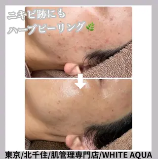 WHITE AQUA 北千住店のエステ・リラクイメージ