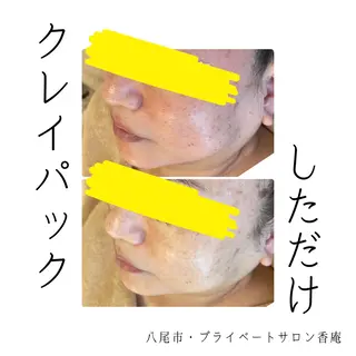 小顔・たるみケア✨ フェイシャル&ボディのエステ・リラクイメージ