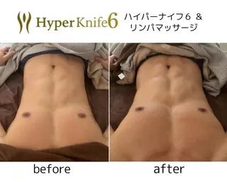 痩身サロンiBDY所属・いわきり ゆきのエステ・リラクイメージ