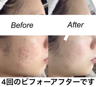 セミロング カラー パーマ ヘアアレンジ ネイル マツエク・マツパ 都度払い肌質改善 &脱毛Blancheのエステ・リラクイメージ