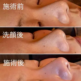 Beauty salon  Liko所属・LIKO フェイシャル&ボディのエステ・リラクイメージ