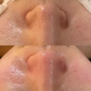 BELCIA福岡店　récolte de BELCIA（レコルトデベルシア）所属・BELCIA福岡店 レコルトデベルシアのエステ・リラクイメージ