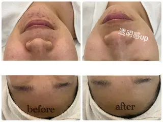 デ・アイム新潟北所属・サイトウ .のエステ・リラクイメージ