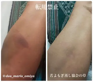 private salon Dea_maris シュガーリング&パーソナルボディケア所属・シミ改善・韓国肌管理 ボディメイク痩身のその他イメージ