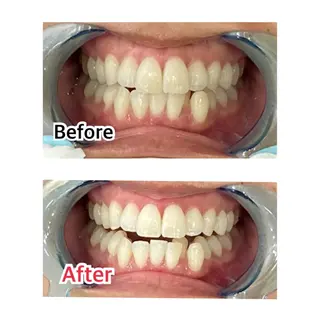 プラチナムビューティー柏所属・【歯科提携】柏ホワイ トニングスタイルのその他イメージ