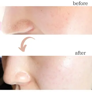 アイブロウ Naps-Shaving所属・敏感肌⭐️ シェービング専門佐藤の眉毛・アイブロウイメージ