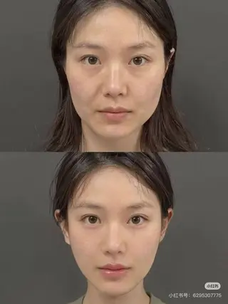 カラー aliaハイフ&水光ジェットサロン所属・aliaハーブ水光店 エステティシャン募集のエステ・リラクイメージ