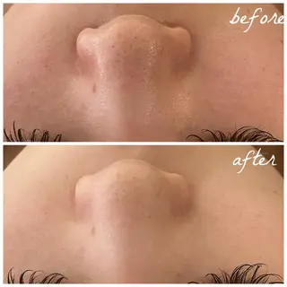 メンズ メナード岐阜茜部 杉浦のエステ・リラクイメージ