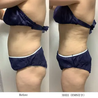 冷却専門店 SLARIのエステ・リラクイメージ