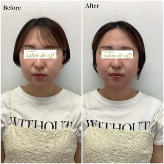 メディカルサロンドオフ所属・ハリサロンドオフ 美容鍼灸×小顔整体のエステ・リラクイメージ