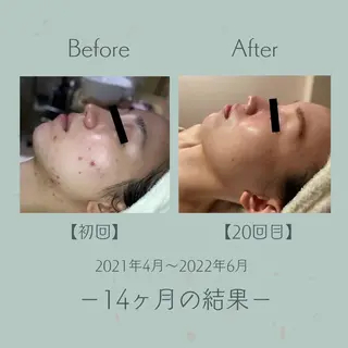 エステ＆美肌脱毛 ココサロ倉敷店のエステ・リラクイメージ