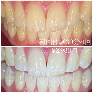 PLATINUM Beauty 横浜店所属・ホワイトニングルーム 横浜店のその他イメージ