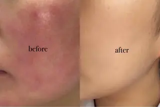 Amv. mananoのエステ・リラクイメージ