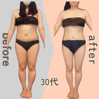 痩身エステ Julien麹町店のエステ・リラクイメージ