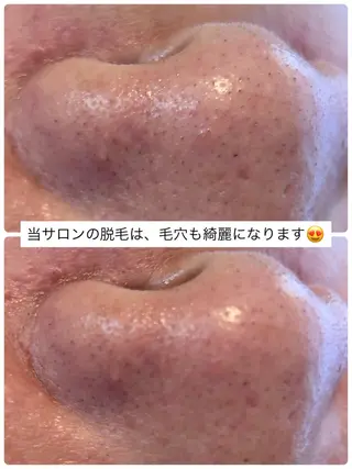 Beauty salon Wish所属・Wish めぐみのエステ・リラクイメージ