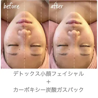 シミケアサロン REVIASオーナーのエステ・リラクイメージ