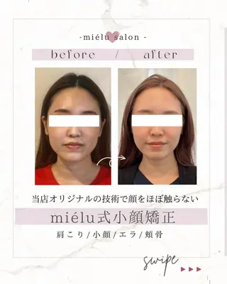 小顔専門salon miélu ミエルのエステ・リラクイメージ