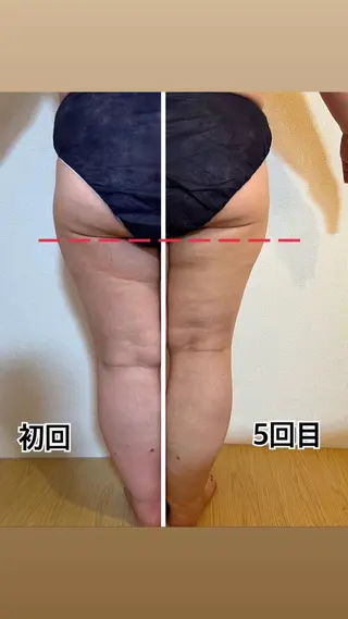 ❤︎MN❤︎ モンのエステ・リラクイメージ