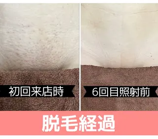 毛穴改善/脱毛 ネイル 川上久仁子のエステ・リラクイメージ