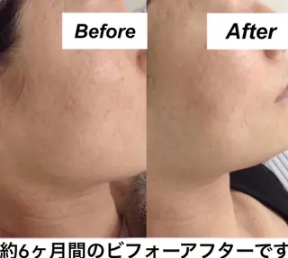 都度払い肌質改善 &脱毛Blancheのエステ・リラクイメージ