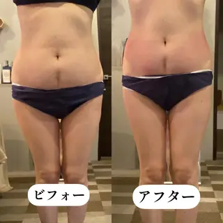 TEIKOKU所属・トータルビューティー TEIKOKUのエステ・リラクイメージ