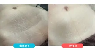 les SALON所属・les SALON／ 痩身／首肩こり／脱毛のエステ・リラクイメージ