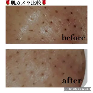 触れたくなる モテ肌へ...❤︎のエステ・リラクイメージ