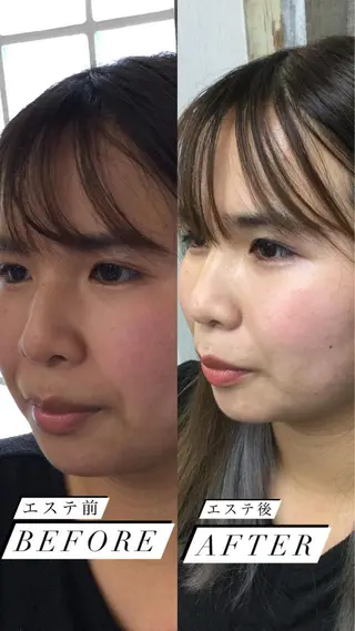 美と癒しのお店OTOHA 2nd所属・OTOHA よしだのエステ・リラクイメージ