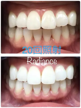 札幌ホワイトニング ラディアンス札幌駅店のその他イメージ