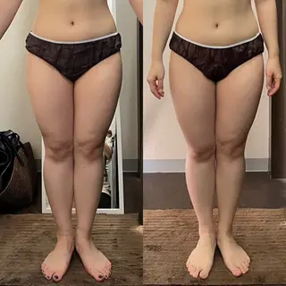 ハイパーナイフ専門店 Salon de COCO所属・Salon de COCOのエステ・リラクイメージ