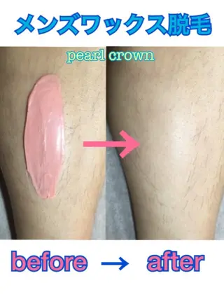 メンズ pearl crown所属・pearlcrown 博多Wax＆光脱毛のその他イメージ