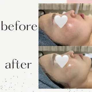 ESTHETIC SALON milulu所属・大栁 晶子のエステ・リラクイメージ
