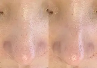 メンズ salonLADYSTYLE所属・稲嶺 美華のエステ・リラクイメージ