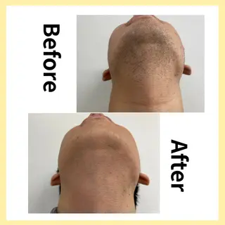 セルフ脱毛/美尻イス キングスサロン熊本のエステ・リラクイメージ