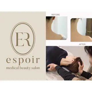 最速小顔・肌質管理 ❣️エスポワールのエステ・リラクイメージ