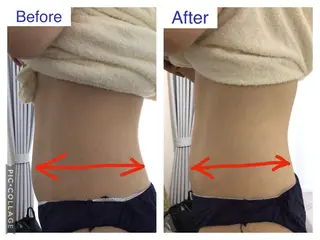 子宮矯正/腸揉み/ シュガーリング脱毛のエステ・リラクイメージ