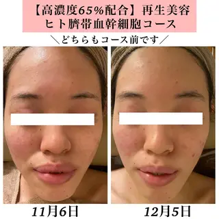 Bellesthe (ベルエステ)のエステ・リラクイメージ