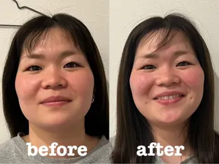 美容鍼灸Solana所属・小櫻 唯のエステ・リラクイメージ