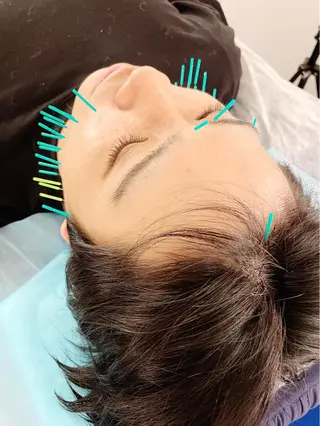 メンズ 小顔美容鍼専門サロン 渋谷YZのエステ・リラクイメージ